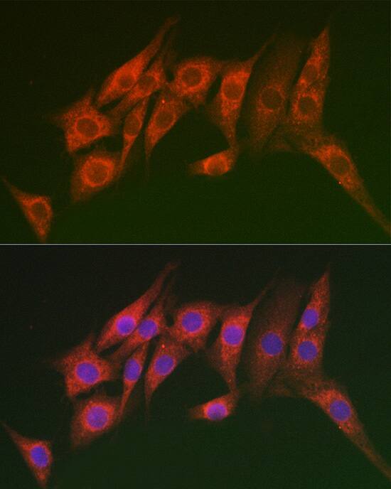 MTMR14 Antibody