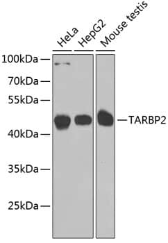 TRBP Antibody