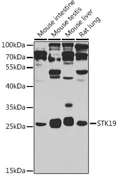 STK19 Antibody