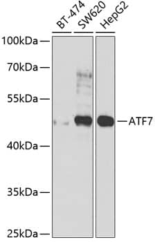 ATF7 Antibody