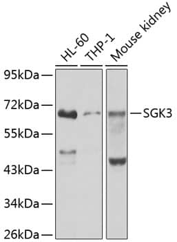 SGK3 Antibody