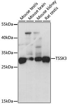 STK22C Antibody