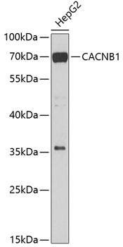 CACNB1 Antibody