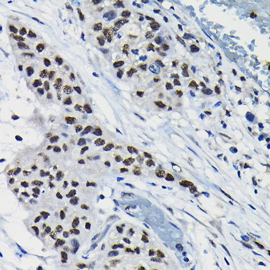DRIL1 Antibody