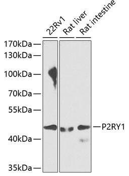 P2Y1/P2RY1 Antibody