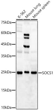 SOCS-1 Antibody