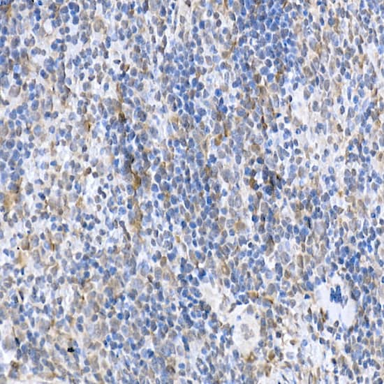 SOCS-1 Antibody