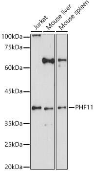 PHF11 Antibody