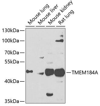 TMEM184A Antibody