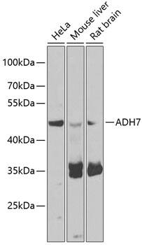 alcohol dehydrogenase 7 Antibody