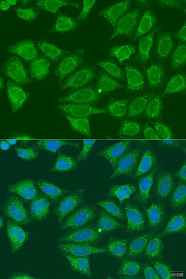 alcohol dehydrogenase 7 Antibody