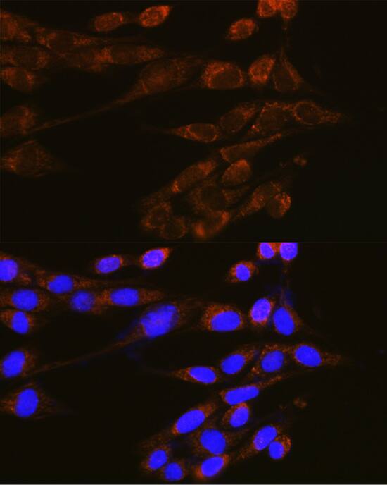 Dynamin 2 Antibody