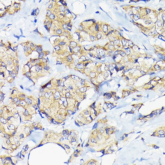 EEF1G Antibody
