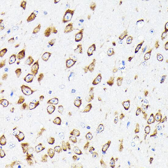EEF1G Antibody