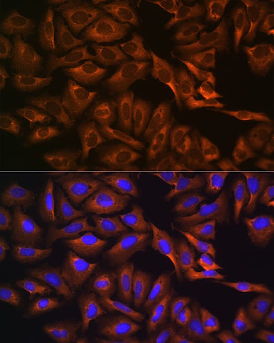 GPIP137 Antibody