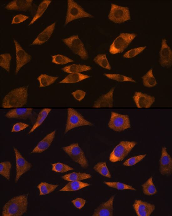 GPIP137 Antibody