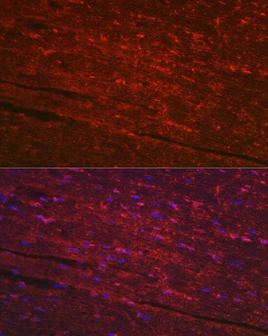 PGAM2 Antibody