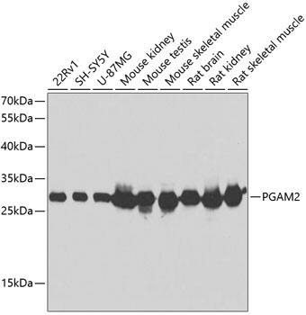 PGAM2 Antibody