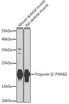 Troponin I type 2 (fast skeletal) Antibody