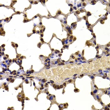 WHSC1 Antibody