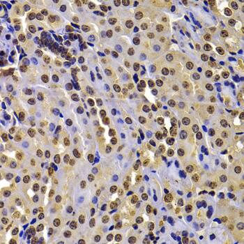 WHSC1 Antibody