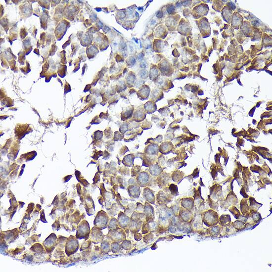 MTHFD1L Antibody