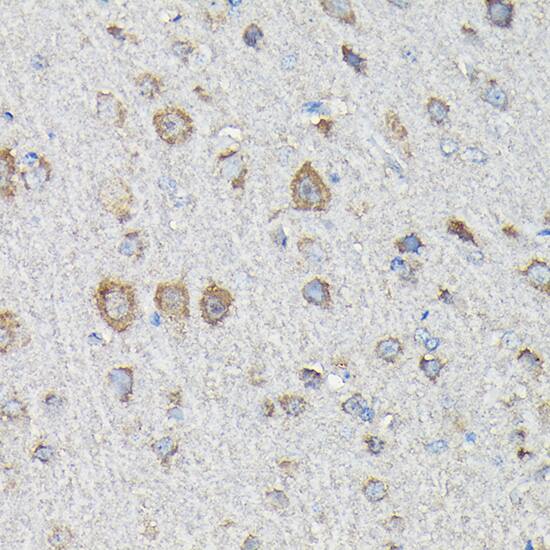 MTHFD1L Antibody