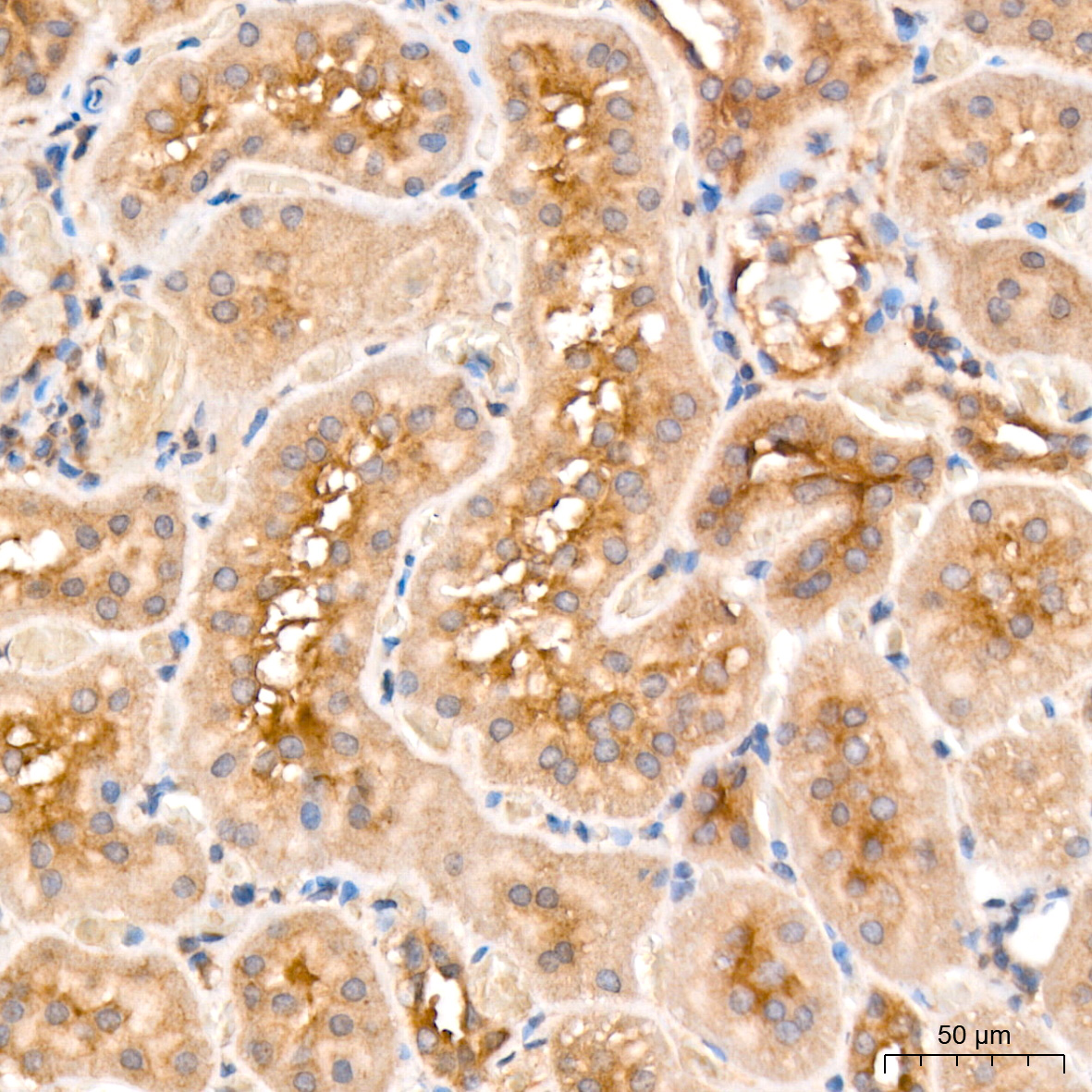 MCCC2 Antibody
