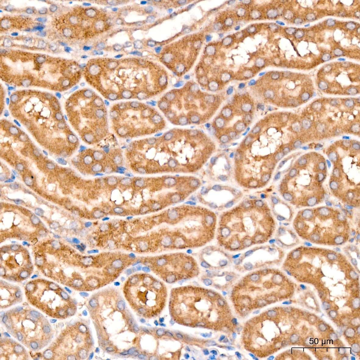 MCCC2 Antibody