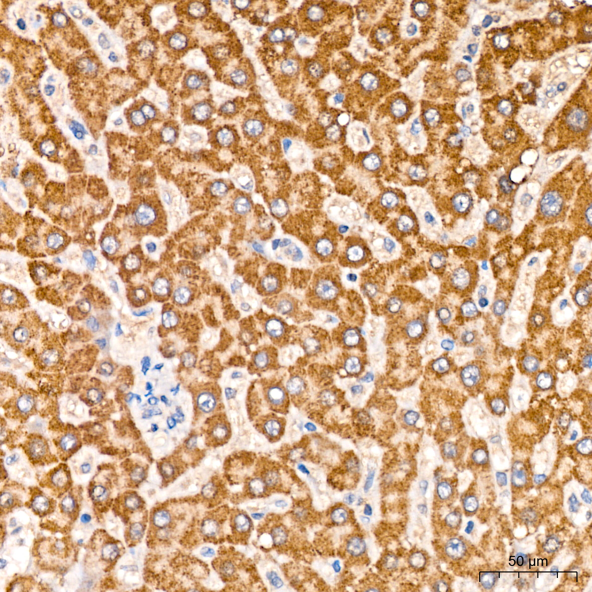 MCCC2 Antibody