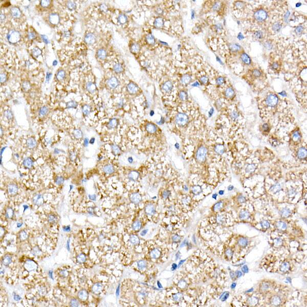 NDUFV1 Antibody