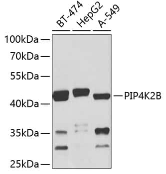 PIP5K2B Antibody