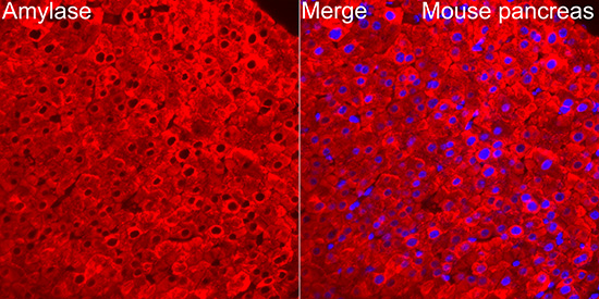 Pancreatic Amylase Alpha Antibody