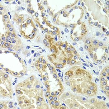 HMGCL Antibody