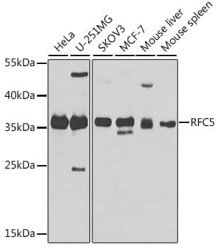 RFC5 Antibody