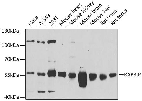 RAB3IP Antibody