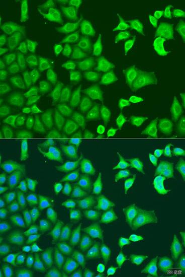 CAPZB Antibody