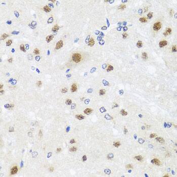 Centrin 3 Antibody