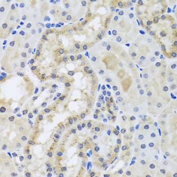 Centrin 3 Antibody