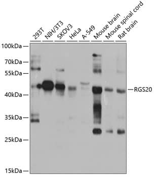 RGS20 Antibody