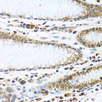 IFI44 Antibody