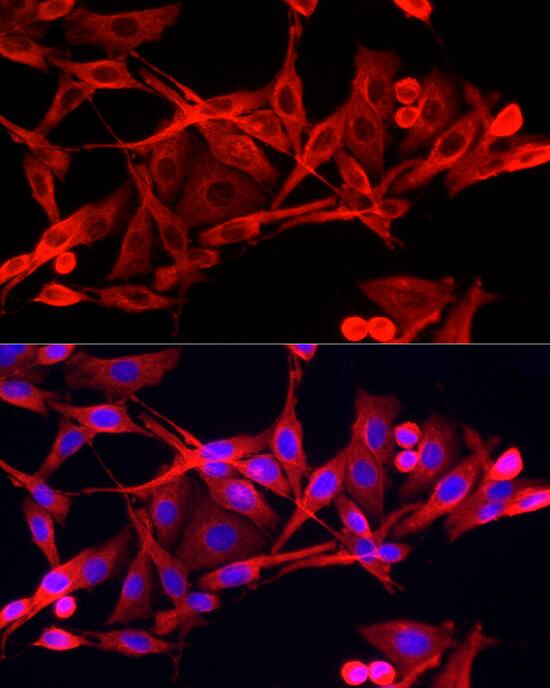 IFI44 Antibody