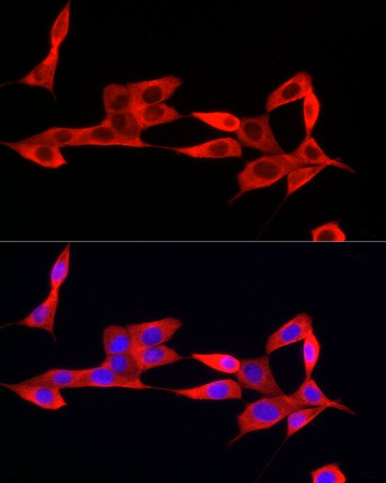 IFI44 Antibody