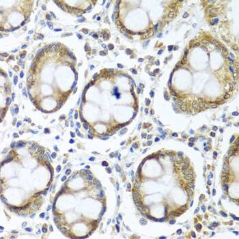 IFI44 Antibody