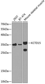 KCTD15 Antibody