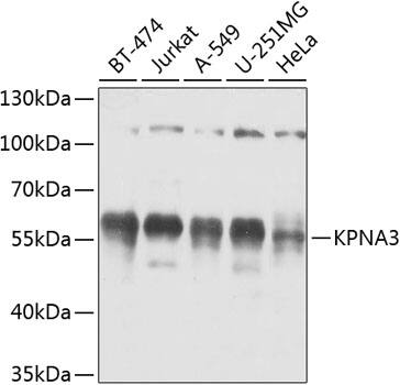 KPNA3 Antibody