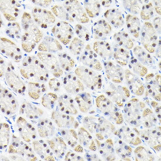 KPNA3 Antibody