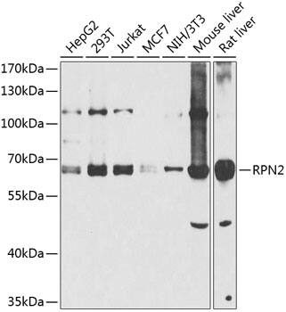 Ribophorin II Antibody