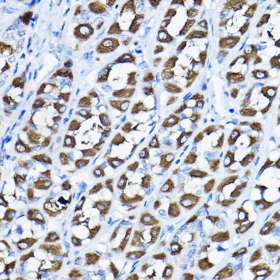 PGLS Antibody
