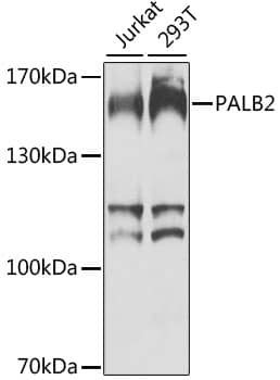 PALB2 Antibody